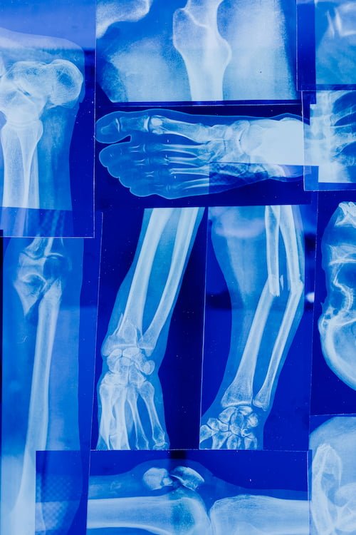 uso di radiazioni in medicina. Radiografia di diverse parti del corpo: braccia, piede, spalla, ginocchio.